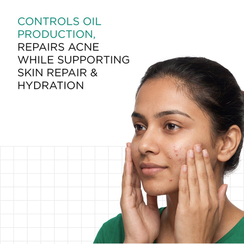 Acne Regime