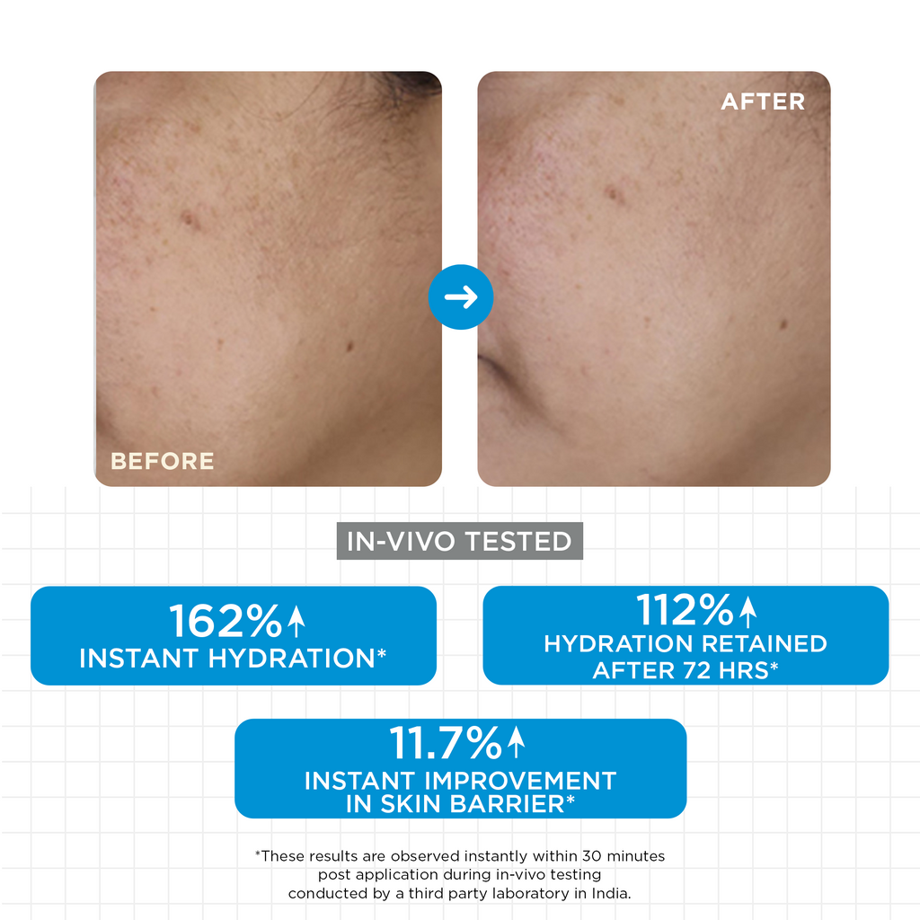 Moisture Balm