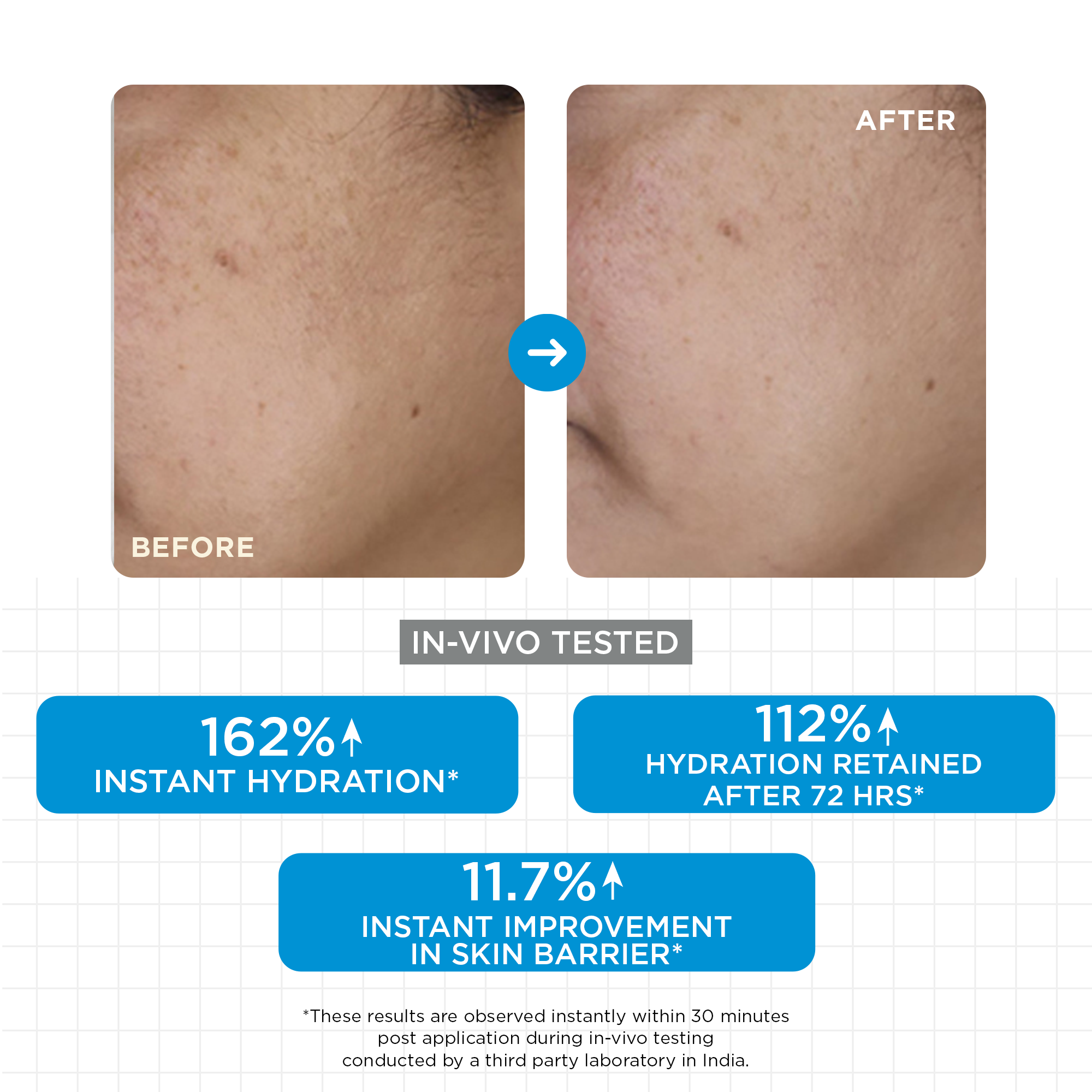 Moisture Balm