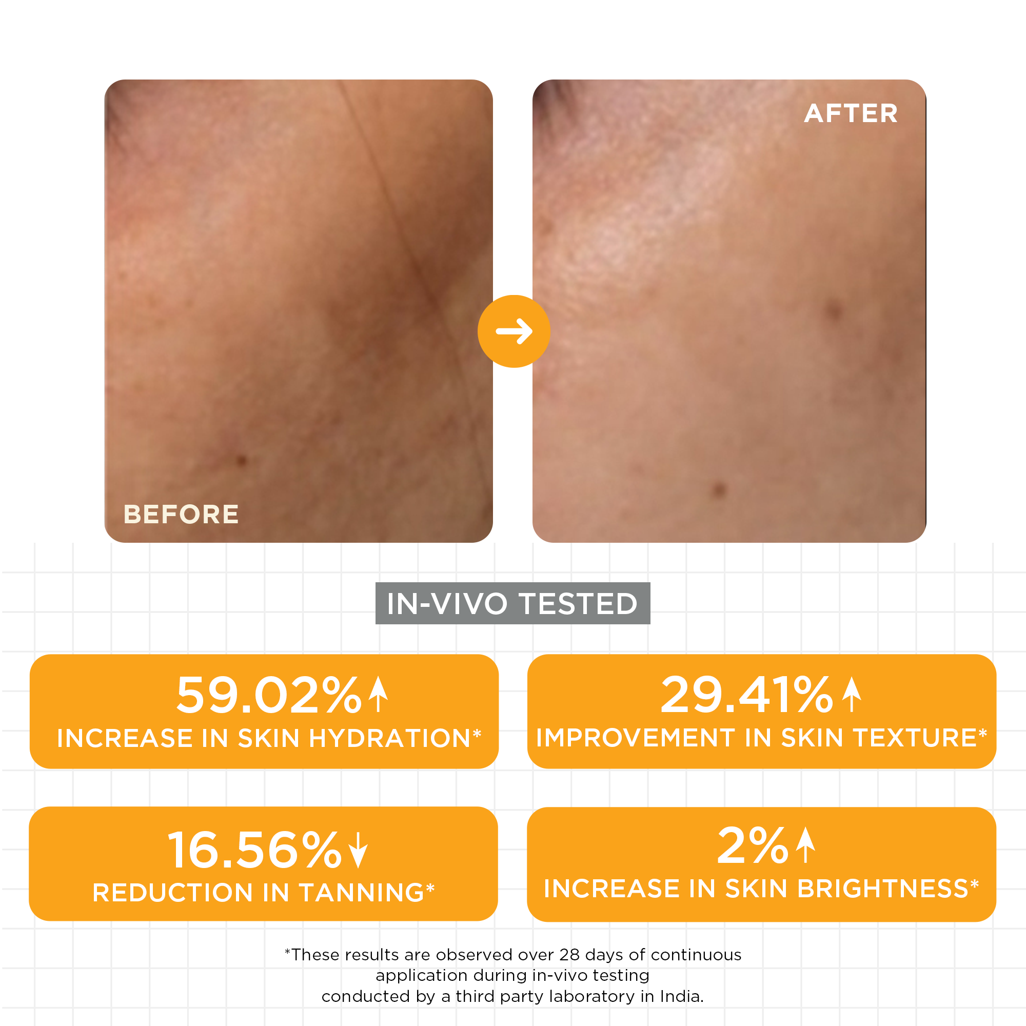 15% Vitamin C Glow Serum