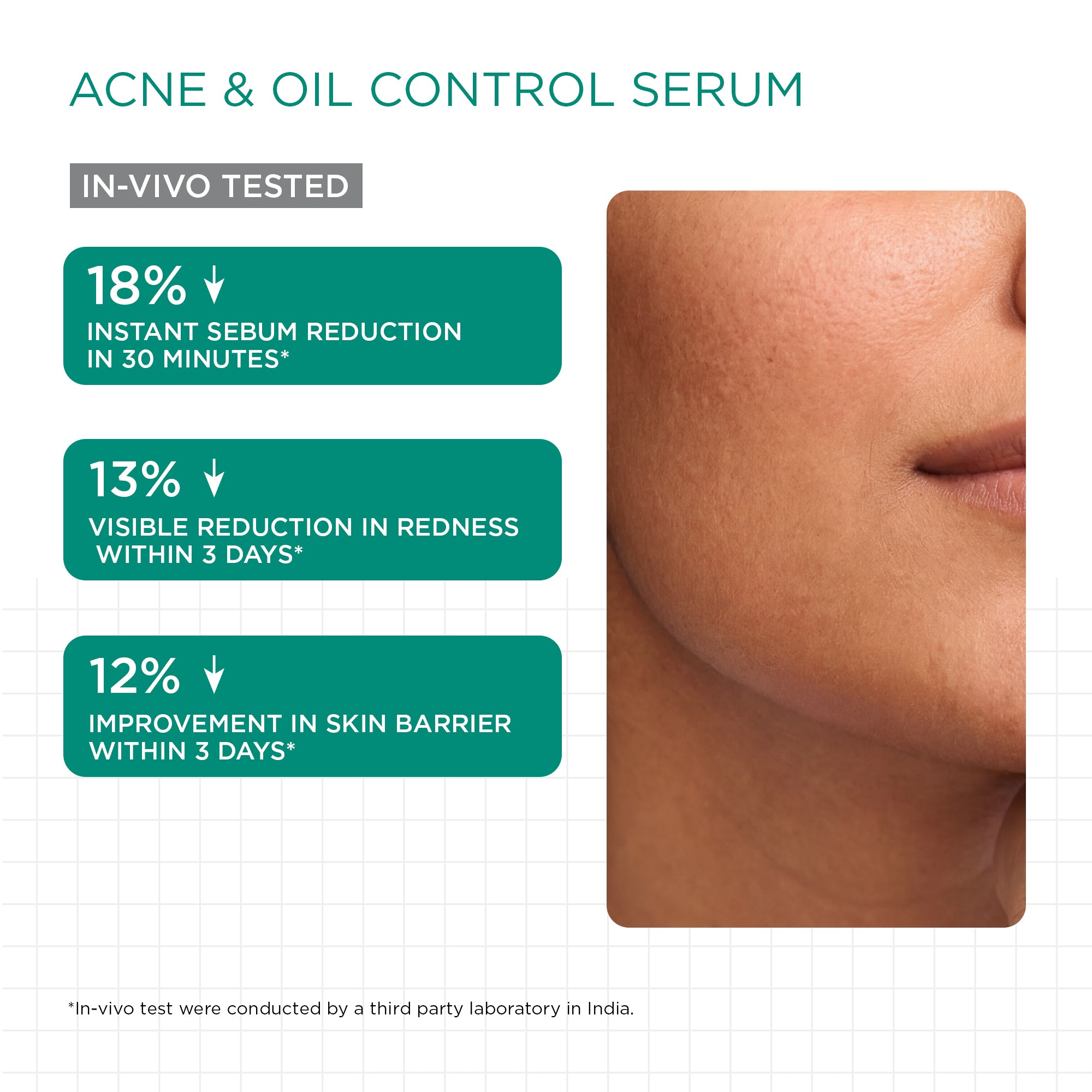 Acne Control Trio
