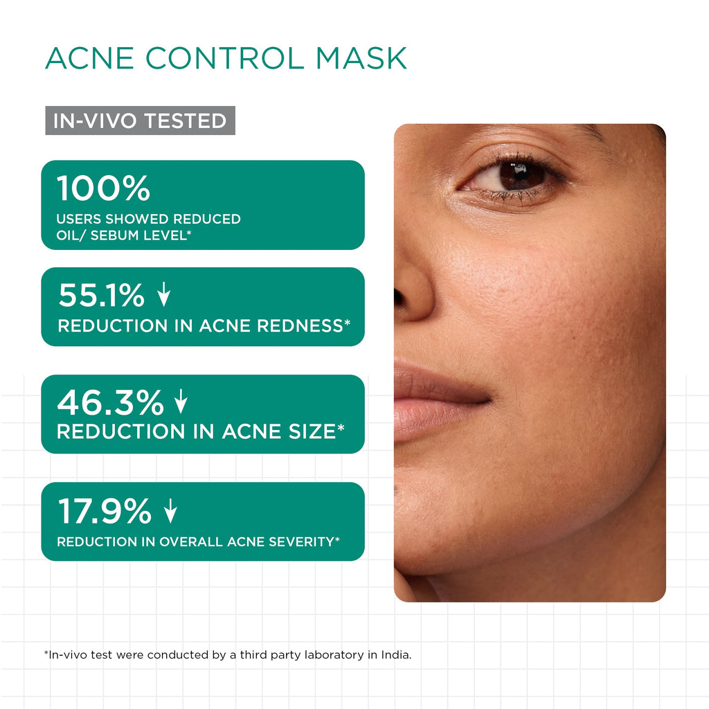 Acne Control Trio